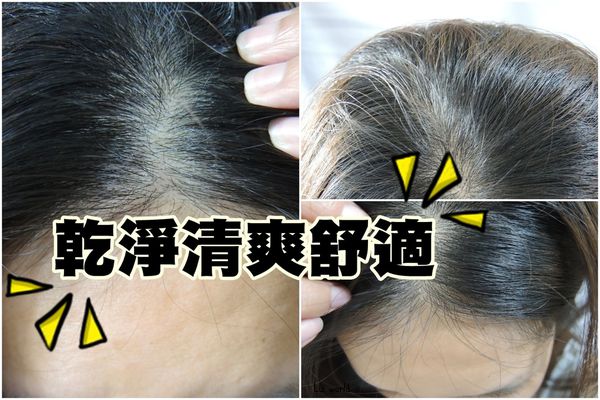 AROMASE艾瑪絲頭皮屑問題三步驟洗護組－脂漏性皮膚炎日常清潔可用